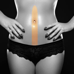 Γραμμή Άνω και Κάτω Κοιλιάς Γυναίκα - Laser Αποτρίχωση - Skin Center