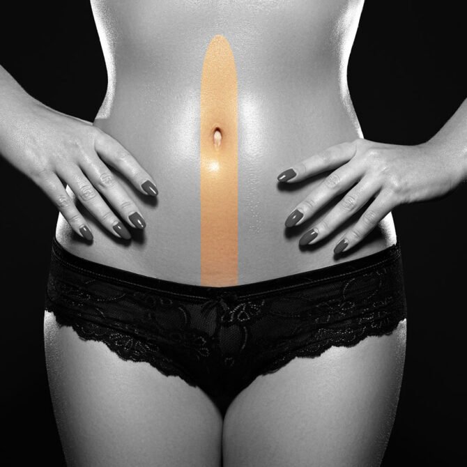Γραμμή Άνω και Κάτω Κοιλιάς Γυναίκα - Laser Αποτρίχωση - Skin Center