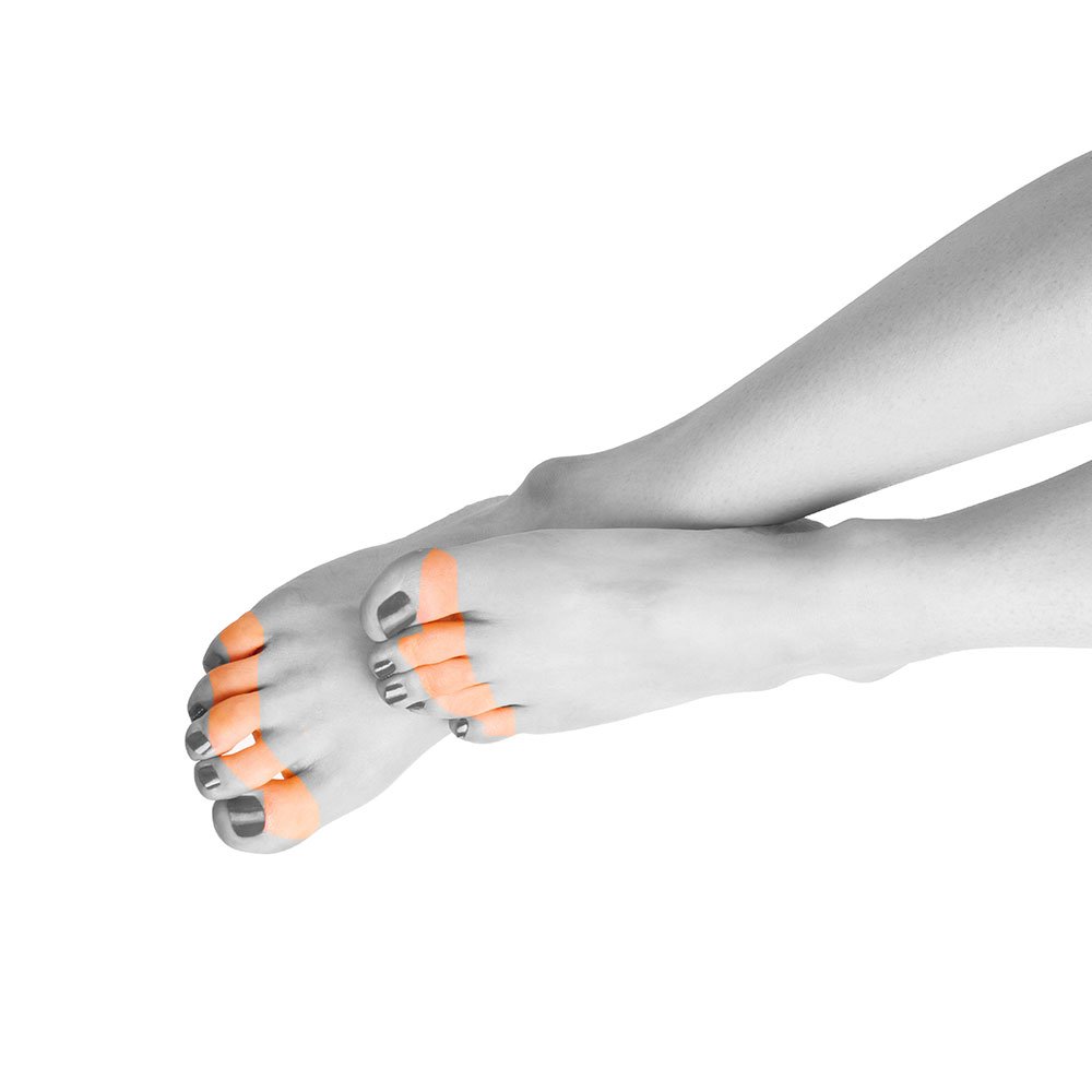 maniac tall courtyard Δάχτυλα Ποδιών : Γυναίκα | Laser Αποτρίχωση Skin Center